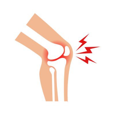 knee-joint-pain-illustration-vector-400-179702857.jpg
